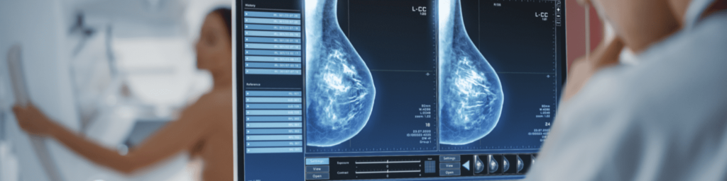 Breast Cancer Screening