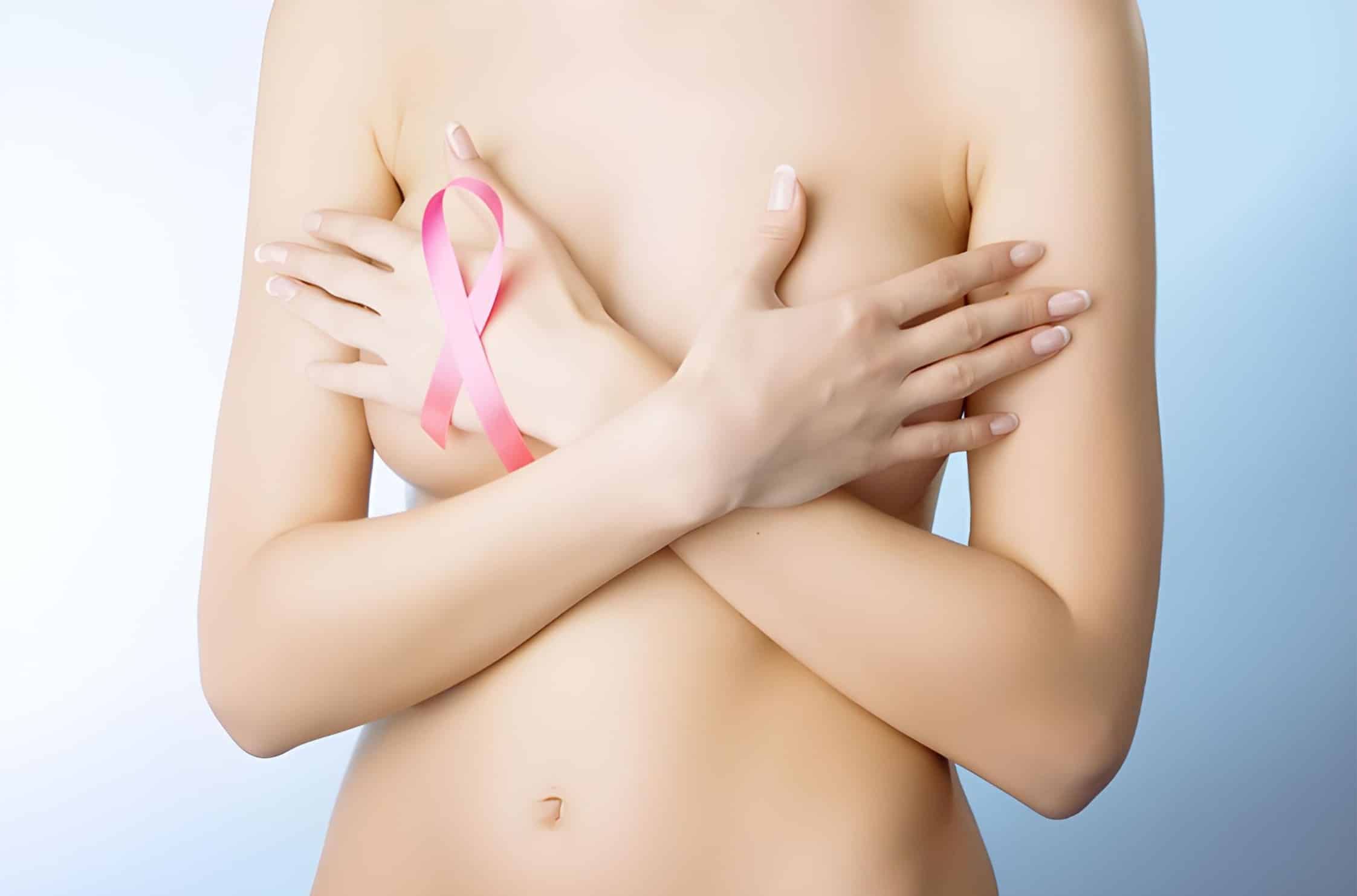 Prophylactic mastectomy